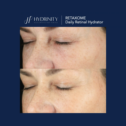 Hydrinity RetaXome Daily Retinal Hydrator
