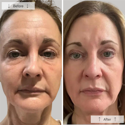 Omnilux Contour LED Face Mask