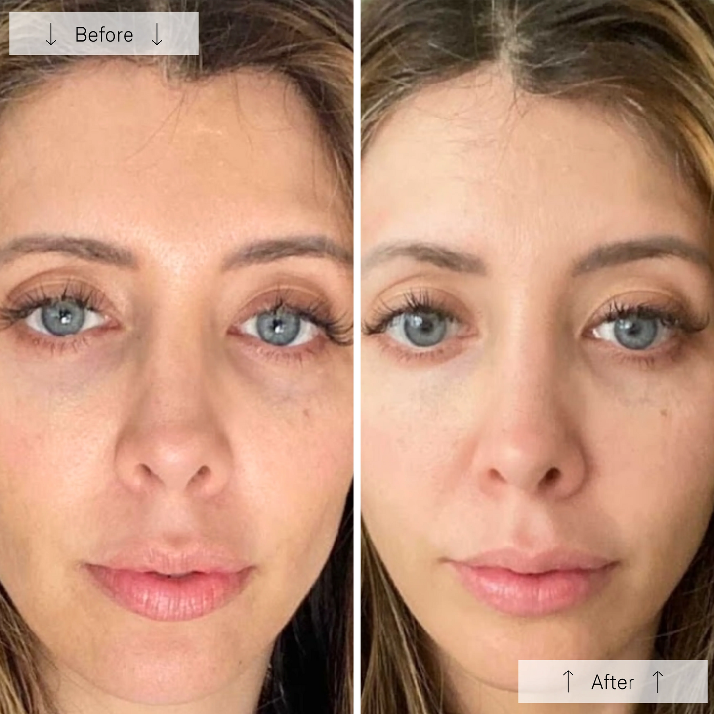 Omnilux Contour LED Face Mask